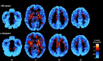 Evidence of Age-Related Hemodynamic and Functional Connectivity Impairment: A Resting State fMRI Study